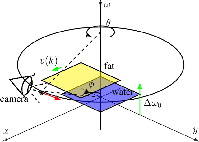 Figure 3 for Volumetric Reconstruction Resolves Off-Resonance Artifacts in Static and Dynamic PROPELLER MRI