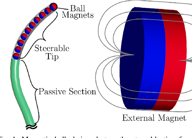 Figure 1 for Magnetic Ball Chain Robots for Endoluminal Interventions