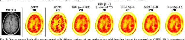 Figure 3 for Multi-Subject Image Synthesis as a Generative Prior for Single-Subject PET Image Reconstruction