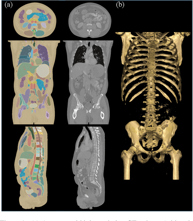 Figure 1 for MAISI: Medical AI for Synthetic Imaging