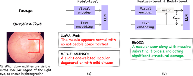 Figure 1 for BioD2C: A Dual-level Semantic Consistency Constraint Framework for Biomedical VQA