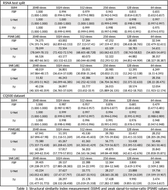 Figure 1 for Improving Automated Hemorrhage Detection in Sparse-view Computed Tomography via Deep Convolutional Neural Network based Artifact Reduction