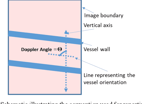 Figure 1 for Automated ultrasound doppler angle estimation using deep learning