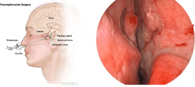 Figure 3 for Live image-based neurosurgical guidance and roadmap generation using unsupervised embedding