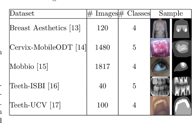 Figure 2 for Learning Ordinality in Semantic Segmentation