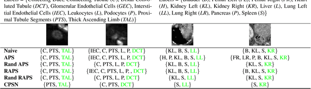 Figure 2 for A conformalized learning of a prediction set with applications to medical imaging classification