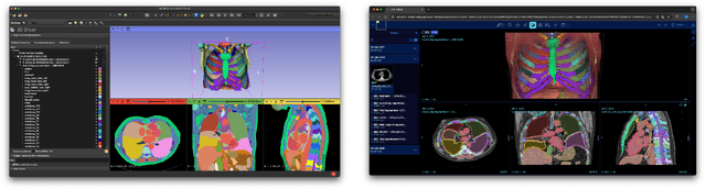 Figure 1 for In search of truth: Evaluating concordance of AI-based anatomy segmentation models