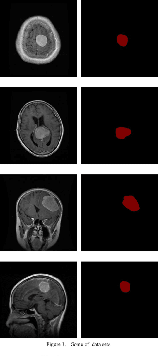 Figure 1 for Improved Unet model for brain tumor image segmentation based on ASPP-coordinate attention mechanism