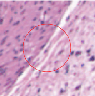 Figure 4 for Reimagining Image Segmentation using Active Contour: From Chan Vese Algorithm into a Proposal Novel Functional Loss Framework