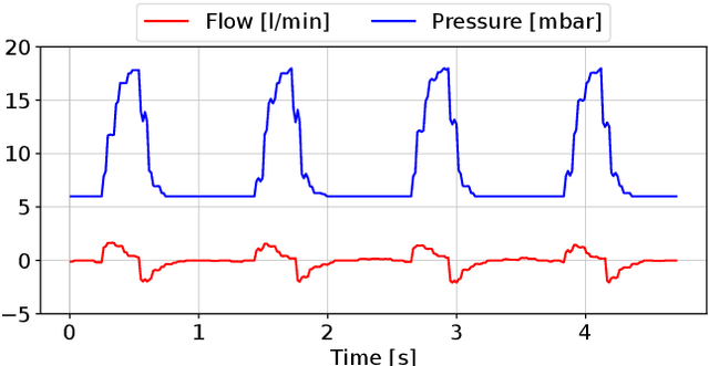 Figure 1 for Evaluating the Explainable AI Method Grad-CAM for Breath Classification on Newborn Time Series Data