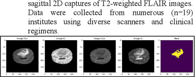 Figure 1 for Deep Learning-Based Brain Image Segmentation for Automated Tumour Detection