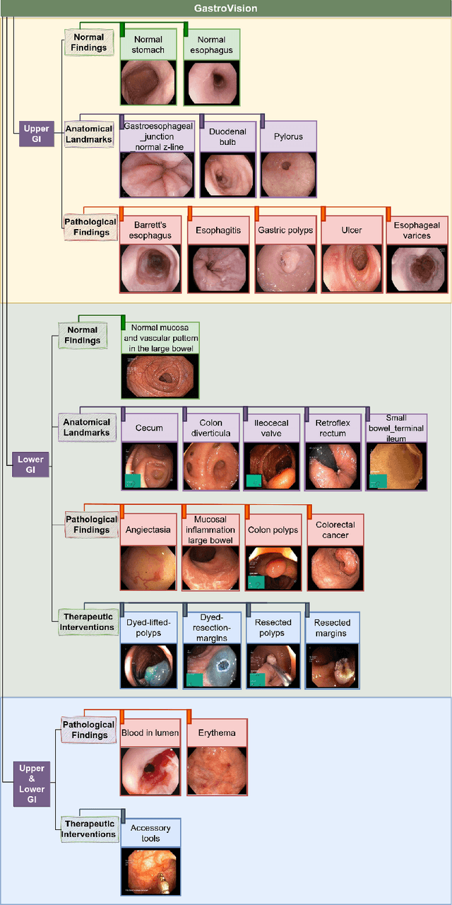 Figure 2 for GastroVision: A Multi-class Endoscopy Image Dataset for Computer Aided Gastrointestinal Disease Detection