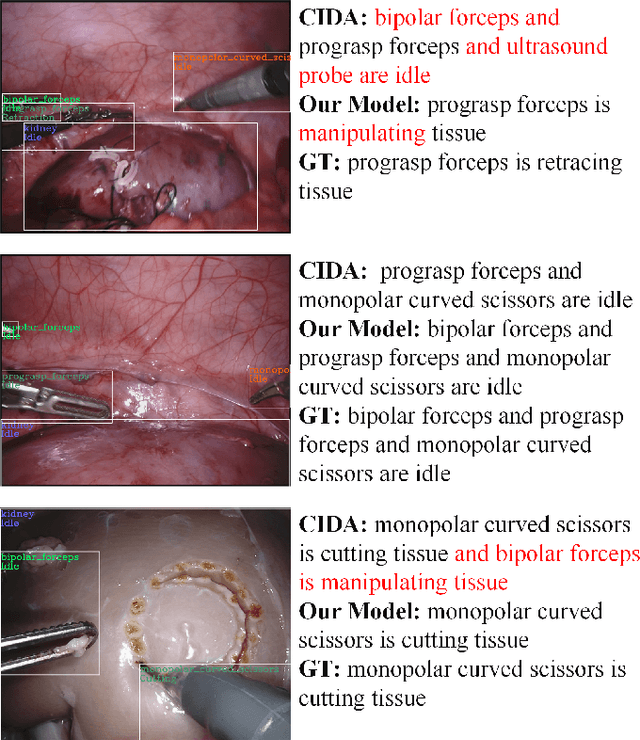 Figure 4 for Dynamic Interactive Relation Capturing via Scene Graph Learning for Robotic Surgical Report Generation
