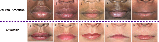 Figure 1 for OXSeg: Multidimensional attention UNet-based lip segmentation using semi-supervised lip contours