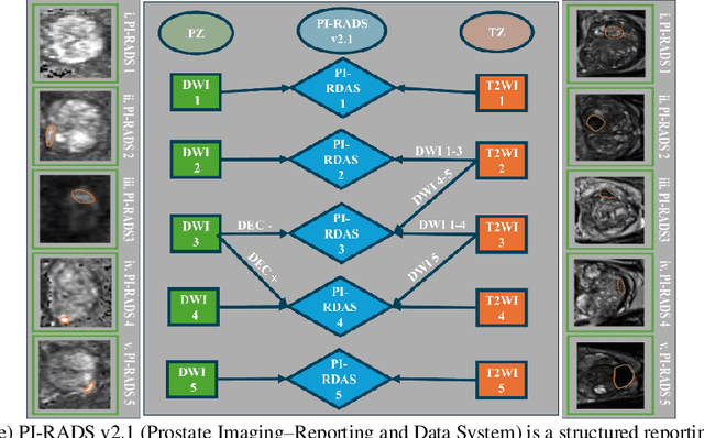 Figure 1 for Biological and Radiological Dictionary of Radiomics Features: Addressing Understandable AI Issues in Personalized Prostate Cancer; Dictionary version PM1.0