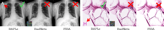 Figure 1 for BAPLe: Backdoor Attacks on Medical Foundational Models using Prompt Learning
