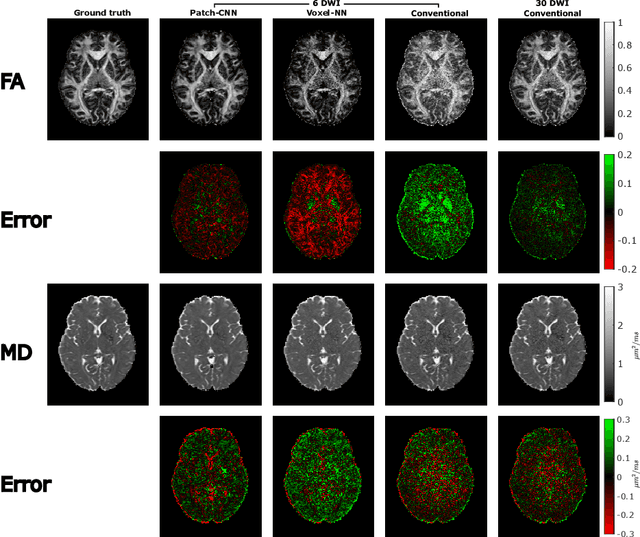 Figure 4 for Patch-CNN: Training data-efficient deep learning for high-fidelity diffusion tensor estimation from minimal diffusion protocols