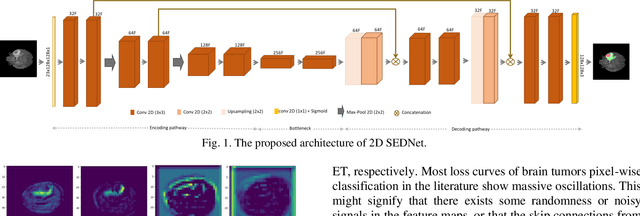 Figure 1 for SEDNet: Shallow Encoder-Decoder Network for Brain Tumor Segmentation