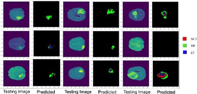 Figure 4 for SEDNet: Shallow Encoder-Decoder Network for Brain Tumor Segmentation