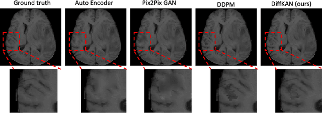 Figure 4 for DiffKAN-Inpainting: KAN-based Diffusion model for brain tumor inpainting