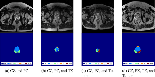 Figure 1 for FAU-Net: An Attention U-Net Extension with Feature Pyramid Attention for Prostate Cancer Segmentation