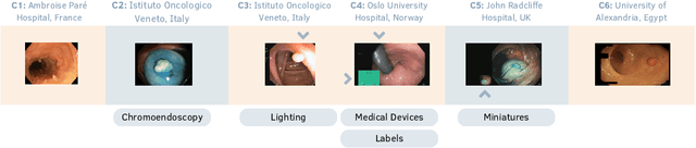 Figure 1 for Unlocking Generalization in Polyp Segmentation with DINO Self-Attention "keys"