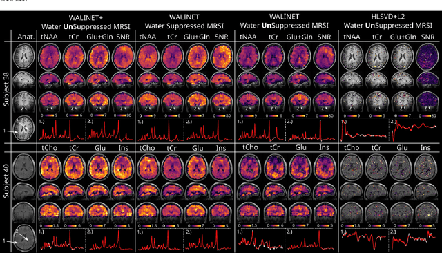 Figure 3 for Deep learning water-unsuppressed MRSI at ultra-high field for simultaneous quantitative metabolic, susceptibility and myelin water imaging