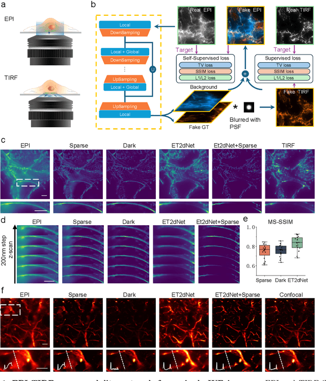 Figure 1 for Deep learning EPI-TIRF cross-modality enables background subtraction and axial super-resolution for widefield fluorescence microscopy