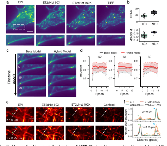Figure 2 for Deep learning EPI-TIRF cross-modality enables background subtraction and axial super-resolution for widefield fluorescence microscopy