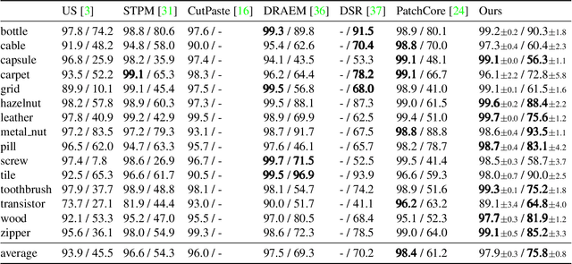 Figure 4 for DeSTSeg: Segmentation Guided Denoising Student-Teacher for Anomaly Detection