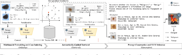 Figure 1 for Retrieval-Augmented VLMs for Multimodal Melanoma Diagnosis