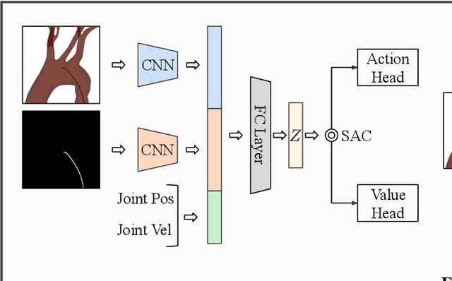 Figure 2 for Towards Autonomous Navigation in Endovascular Interventions