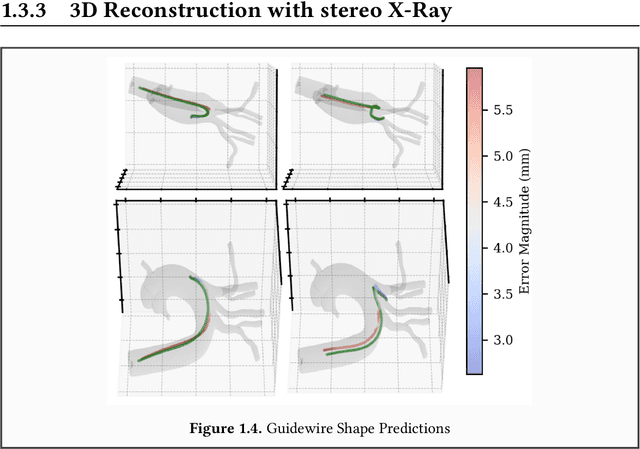 Figure 3 for Towards Autonomous Navigation in Endovascular Interventions