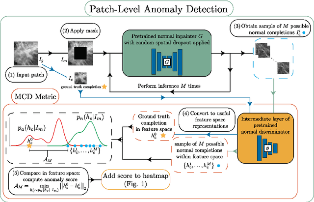 Figure 3 for Unsupervised anomaly localization in high-resolution breast scans using deep pluralistic image completion
