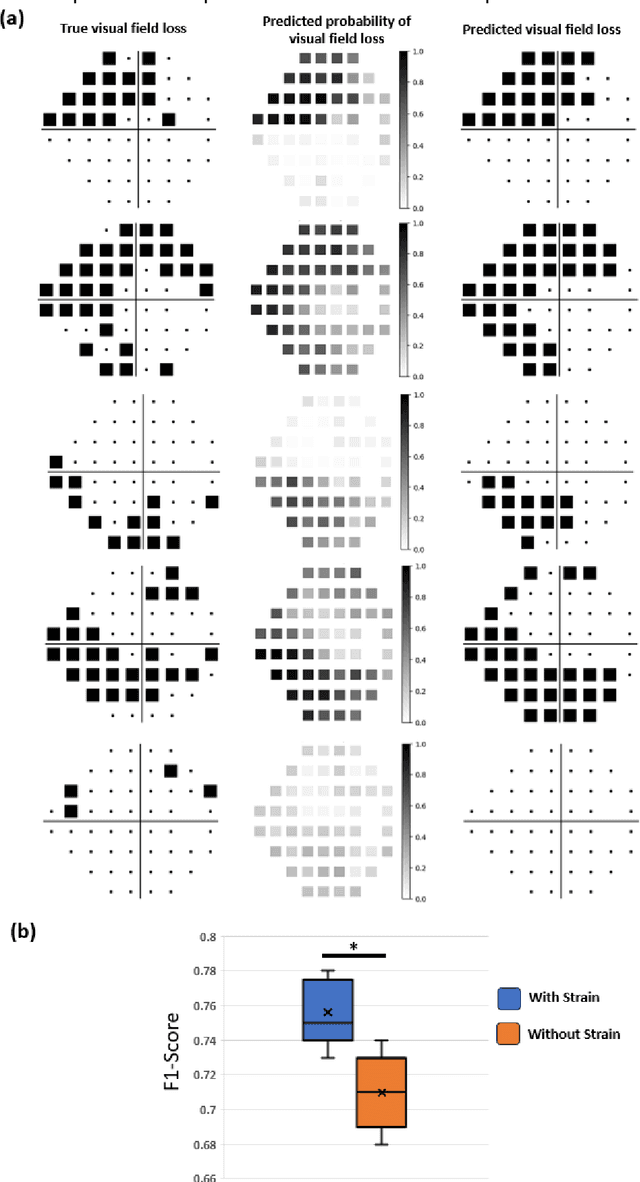 Figure 2 for Introducing the Biomechanics-Function Relationship in Glaucoma: Improved Visual Field Loss Predictions from intraocular pressure-induced Neural Tissue Strains