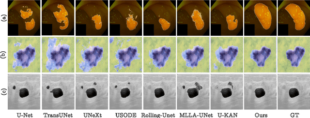 Figure 3 for Implicit U-KAN2.0: Dynamic, Efficient and Interpretable Medical Image Segmentation