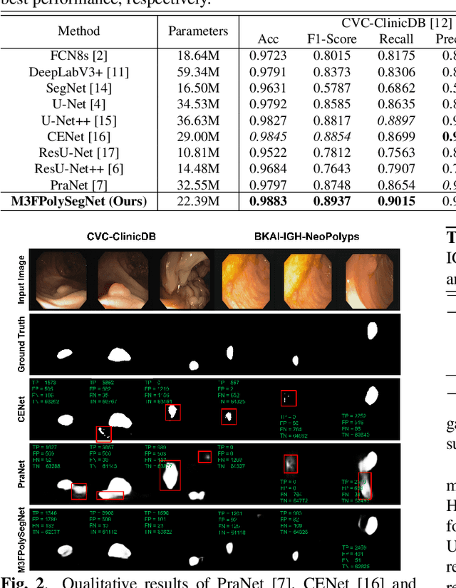 Figure 3 for M3FPolypSegNet: Segmentation Network with Multi-frequency Feature Fusion for Polyp Localization in Colonoscopy Images