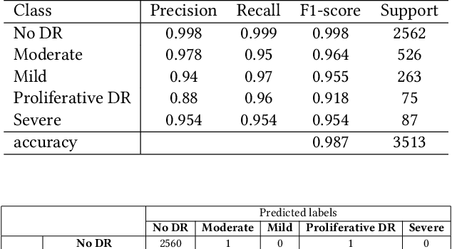 Figure 2 for Diabetic Retinopathy Detection Using CNN with Residual Block with DCGAN