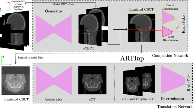 Figure 2 for ARTInp: CBCT-to-CT Image Inpainting and Image Translation in Radiotherapy