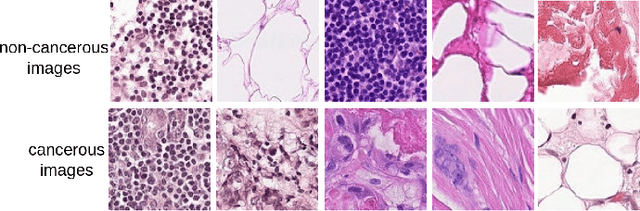 Figure 2 for Adversarial attacks on hybrid classical-quantum Deep Learning models for Histopathological Cancer Detection
