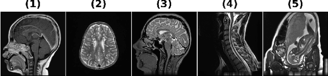 Figure 2 for Non-convex regularization based on shrinkage penalty function