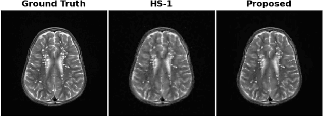 Figure 4 for Non-convex regularization based on shrinkage penalty function