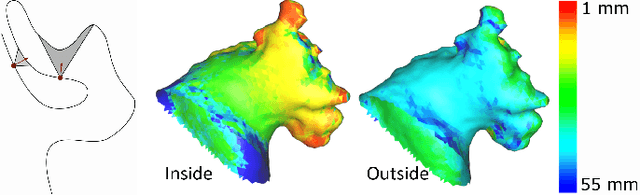 Figure 3 for NUDF: Neural Unsigned Distance Fields for high resolution 3D medical image segmentation