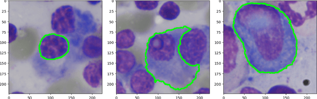 Figure 1 for Boosting Medical Image Segmentation Performance with Adaptive Convolution Layer