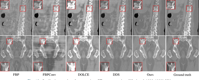 Figure 2 for 3D MedDiffusion: A 3D Medical Diffusion Model for Controllable and High-quality Medical Image Generation