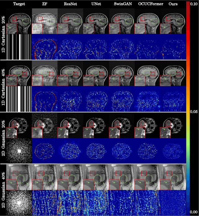 Figure 4 for Continuous K-space Recovery Network with Image Guidance for Fast MRI Reconstruction