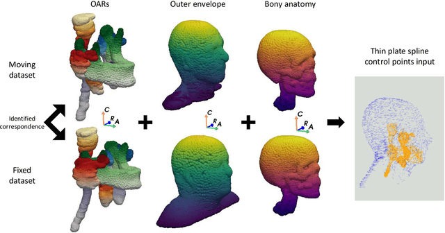 Figure 1 for An anatomically-informed correspondence initialisation method to improve learning-based registration for radiotherapy