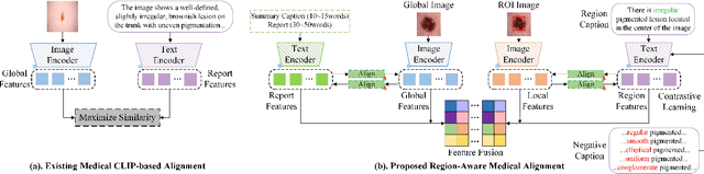 Figure 3 for RegionMed-CLIP: A Region-Aware Multimodal Contrastive Learning Pre-trained Model for Medical Image Understanding