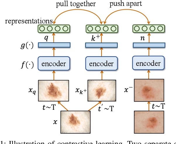 Figure 1 for Federated Contrastive Learning for Dermatological Disease Diagnosis via On-device Learning