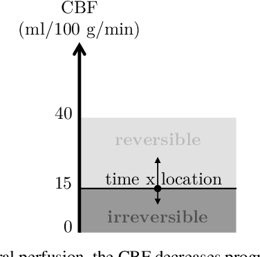 Figure 2 for Final infarct prediction in acute ischemic stroke